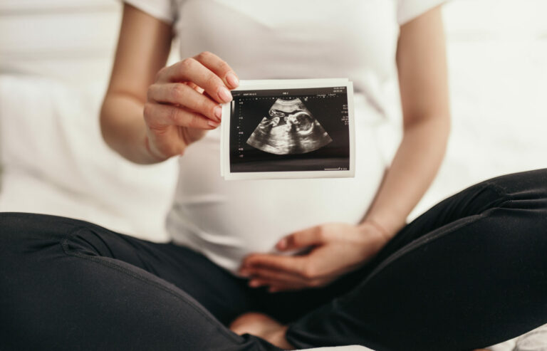 A pregnant woman holding a sonogram.